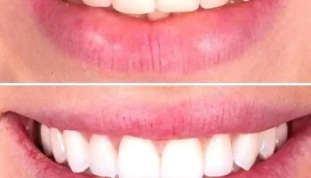 Dental Studio Dr. Irena Hristov - Струмица