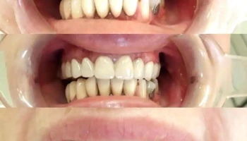 Pzu Sul Dental - Velebrdo