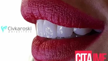 Д-р Цивкароски - Битола
