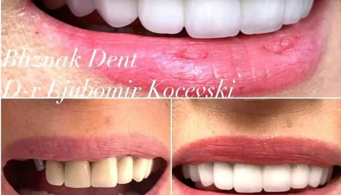 Bliznak Dent D Rljubomir Kotsevski Zab - Тетово