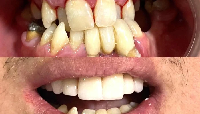 Blu Dent Dental Polyclinic -  Od Sopstvenikot - Тетово