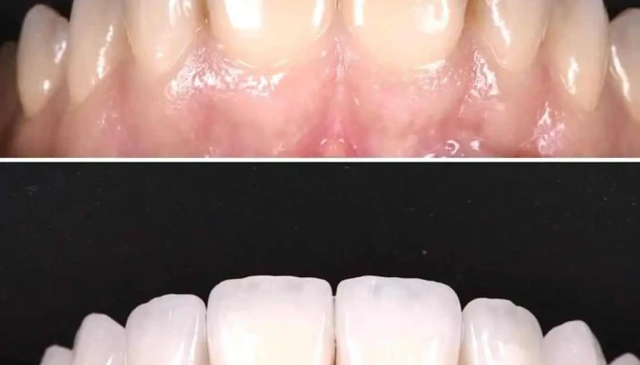 Blu Dent Dental Polyclinic -  Zab - Тетово