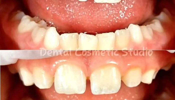 Dental Cosmetic Studio -  Od Sopstvenikot - Скопје
