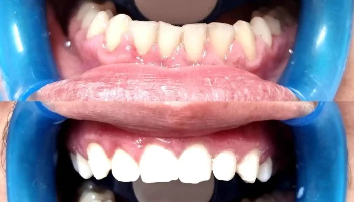 Dental -  Lm Od Sopstvenikot - Боговиње