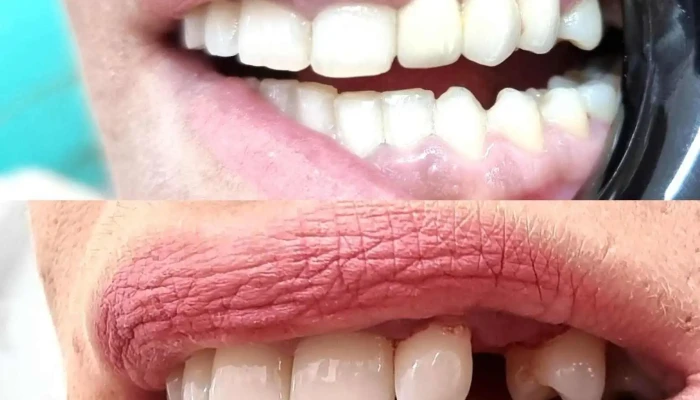 Dental -  Lm Sie - Боговиње