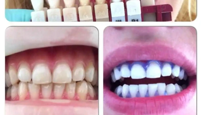 Dental Practice -  Zab - Струга