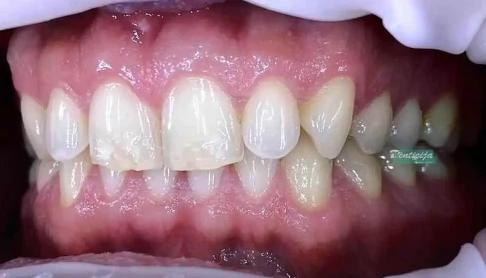 Denticija -  Od Sopstvenikot - Гевгелија