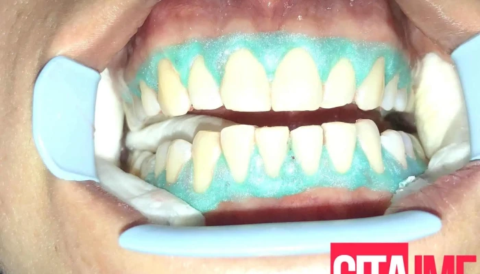 Dentist Skopje -  Zab - Скопје