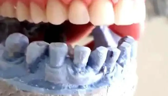Pzu Sul Dental -  Videa - Velebrdo
