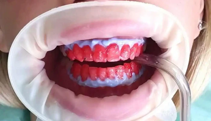 Sanodent -    Dental Clinic Implant Aesthetic Center Od Sopstvenikot - Гостивар