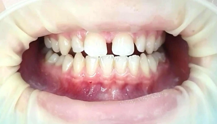 Sanodent -    Dental Clinic Implant Aesthetic Center Sie - Гостивар