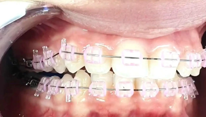 Sanodent -    Dental Clinic Implant Aesthetic Center Videa - Гостивар