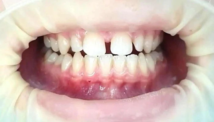 Sanodent - Dental Clinic / Implant & Aesthetic Center - Гостивар