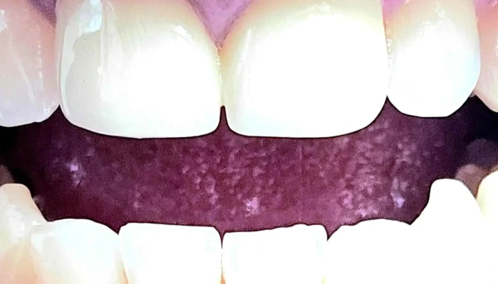 Stomatoloska Ordinacija Dentallica Novo Lisice - Скопје