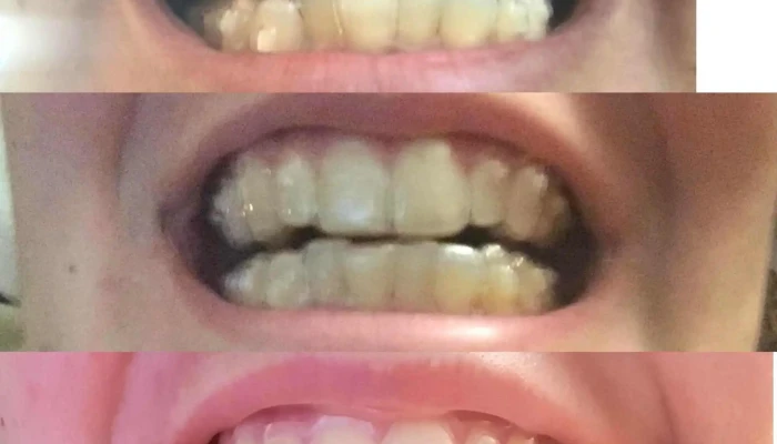 Tilevi Dental -  стоматолог - Охрид